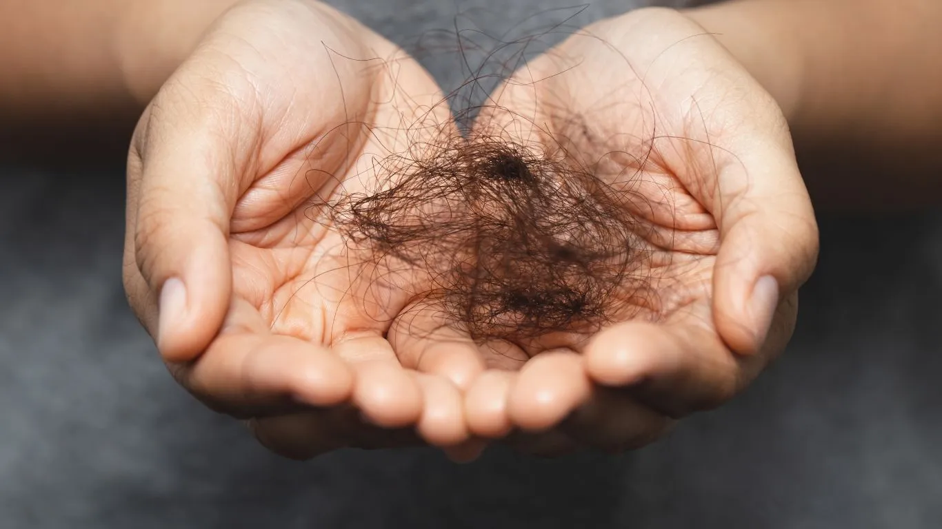 Hair Loss and Its Types